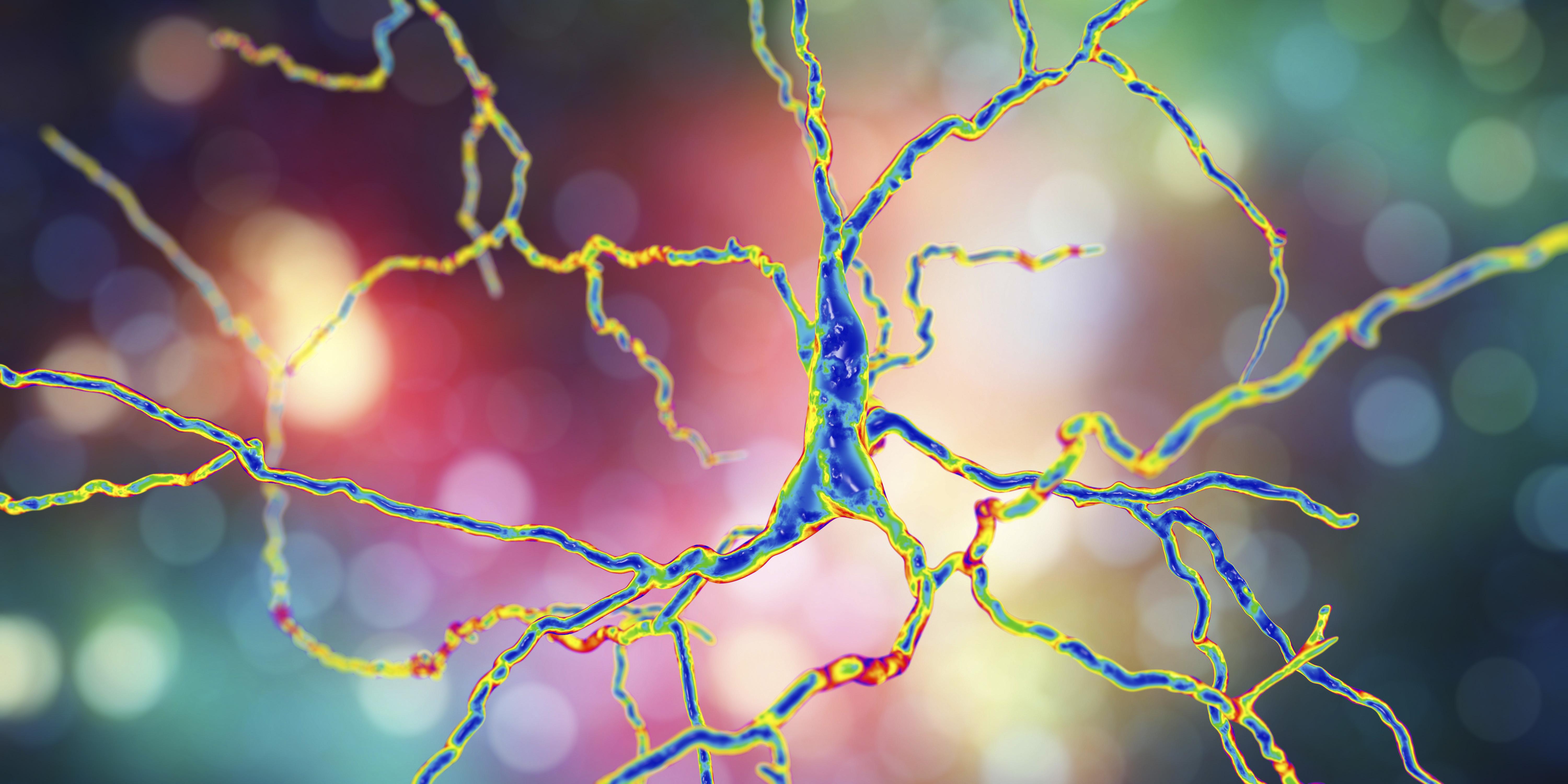 Une nouvelle immunothérapie contre « Alzheimer » cible spécifiquement les oligomères bêta-amyloïdes (Visuel AdobeStock_193981837) Une nouvelle immunothérapie contre « Alzheimer » cible spécifiquement les oligomères bêta-amyloïdes (Visuel AdobeStock_193981837)