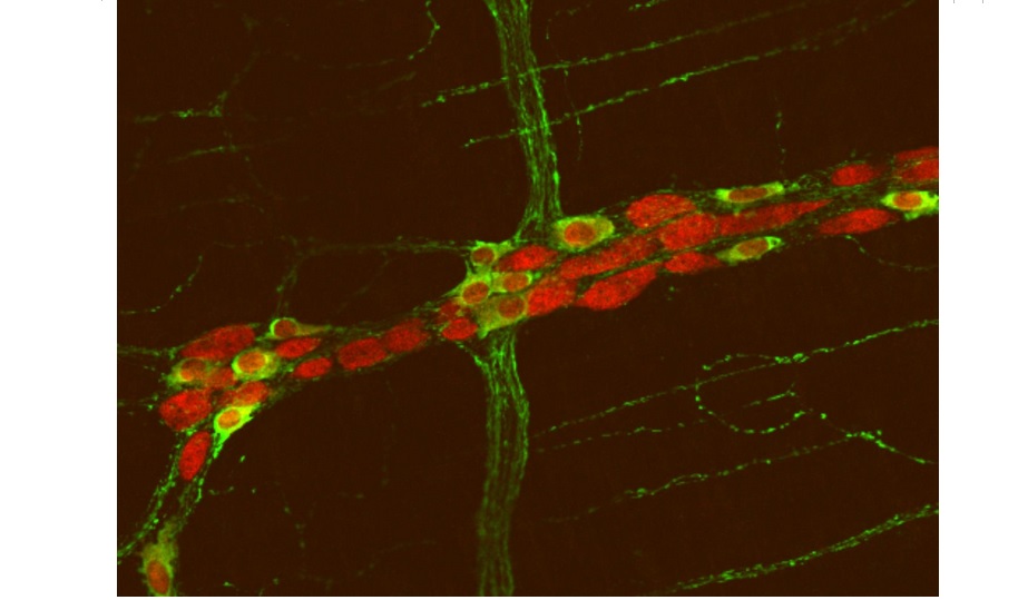 Les mêmes mutations génétiques - découvertes à la fois dans le cerveau et dans les intestins - pourraient être la cause commune des problèmes intestinaux et des dysfonctionnements cérébraux constatés dans l’autisme.