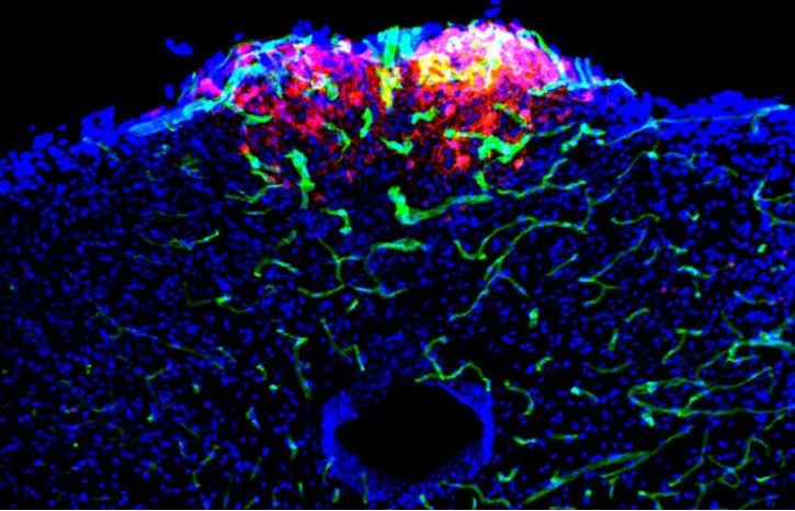 Les neurones GLP1R (en rouge ) jouent un rôle clé dans la détection des toxines dans les vaisseaux sanguins (en vert) et dans le déclenchement de la réponse nauséeuse (Visuel Chuchu Zhang , Stephen Liberles). 
