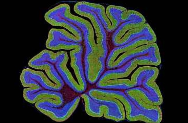 Un sous-ensemble de neurones cérébelleux (situés dans le cervelet) semble fortement impliqué dans la signalisation de la satiété (Visuel cervelet souris - Visuel NIH)