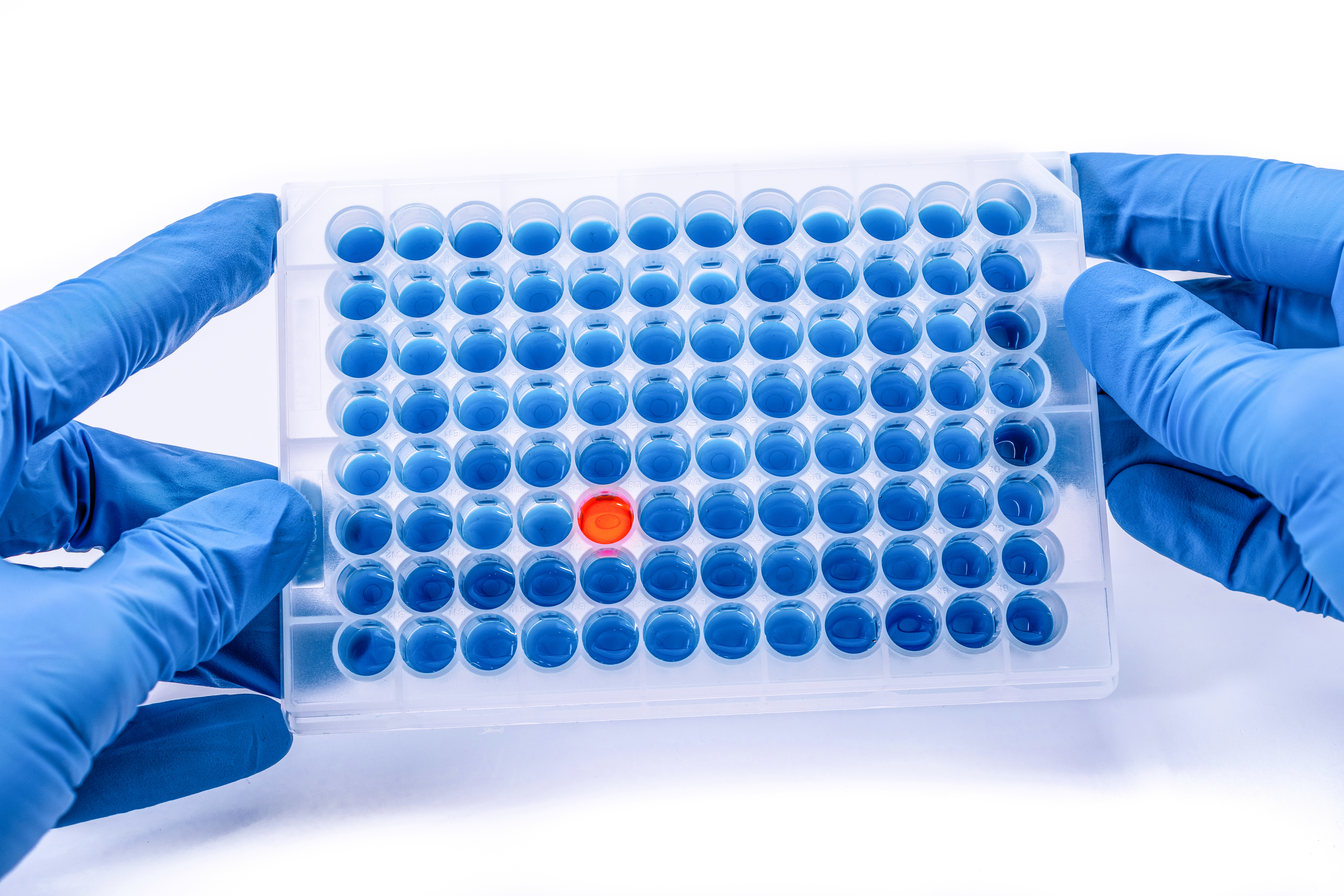 L'étude décrypte comment certains virus provoquent le cancer (Visuel Adobe Stock 191522632) L'étude décrypte comment certains virus provoquent le cancer (Visuel Adobe Stock 191522632)