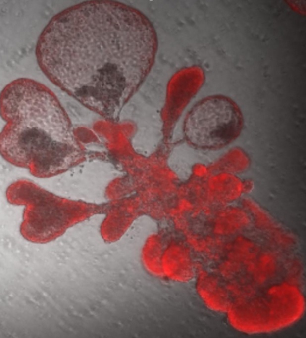 Il suffit d’une seule cellule souche pulmonaire qui se réplique pour générer des milliers de cellules puis une structure en forme de bulle qui ressemble aux tissus respiratoires du poumon humain (Visuel Arvind Konkimalla/Tata lab, Duke University). Il suffit d’une seule cellule souche pulmonaire qui se réplique pour générer des milliers de cellules puis une structure en forme de bulle qui ressemble aux tissus respiratoires du poumon humain (Visuel Arvind Konkimalla/Tata lab, Duke University).