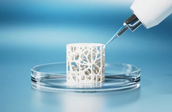 Ce verre bioactif imprimable qui présente de nombreuses similitudes avec le tissu osseux, est tout à fait efficace comme substitut osseux (Visuel Adobe Stock 1324028968)