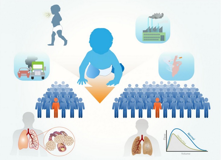 La petite enfance est confirmée comme une période critique de développement pulmonaire (Visuel Fuad Bahram) 