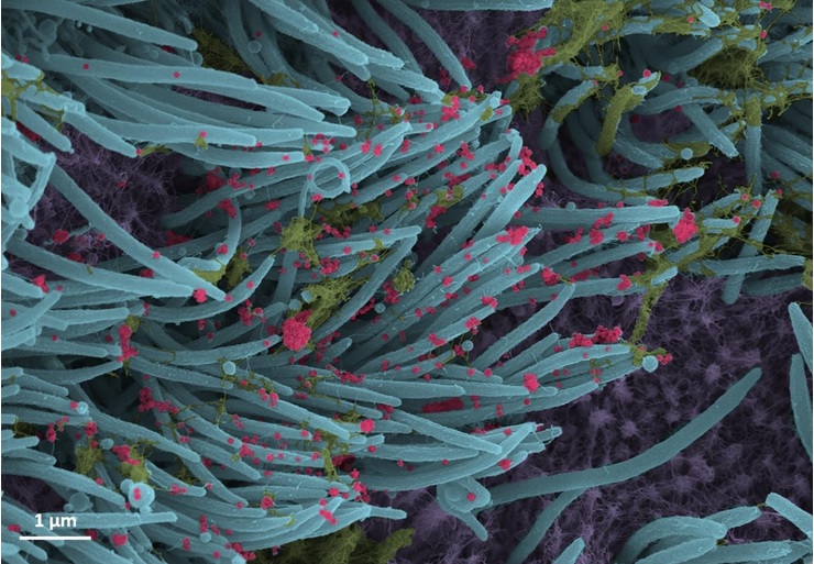 Des images microscopiques et saisissantes de l’infection des cellules épithéliales humaines par le coronavirus SARS-CoV-2 (Visuel Ehre Lab, École de médecine UNC).
