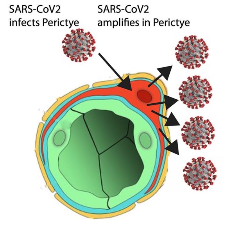 Ces scientifiques de l’Université de Californie - San Diego viennent de décrypter précisément, à l’aide d’un assembloïde en 3D comment le virus SRAS-CoV-2 responsable du COVID-19 se propage dans les vaisseaux sanguins pour infecter les péricytes  et atteindre le cerveau (Schéma UC San Diego Health Sciences)