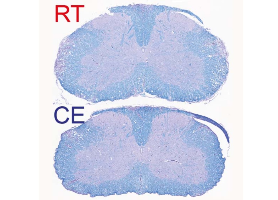 Les lésions démyélinisées apparaissent réduites en cas d’exposition au froid (EC sur visuel : exposed to cold) vs à température ambiante (RT : room temperature) (Visuel UNIGE - Laboratoires Trajkovski & Merkler /Métabolisme Cellulaire). 