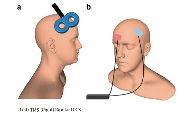 2 formes de stimulation couramment utilisées, la stimulation transcrânienne à courant continu (tDCS-b) et la stimulation magnétique transcrânienne (TMS-a) (Visuel NIH)
