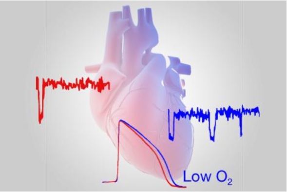 De faibles niveaux d'oxygène dans le cœur sont un facteur connu d’arythmies pouvant être mortelles. 