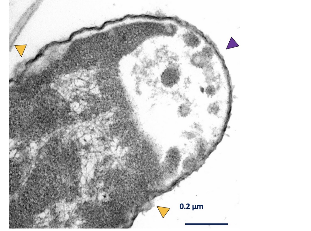 Des images microscopiques des bactéries ciblées permettent de visualiser où les moteurs ont percé leurs parois cellulaires.