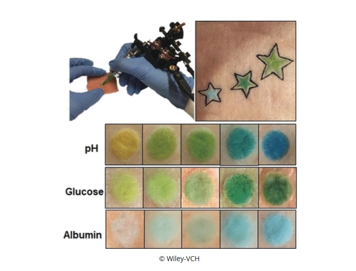 La couleur du tatouage varie avec le changement de différents biomarqueurs, dont le pH du sang.