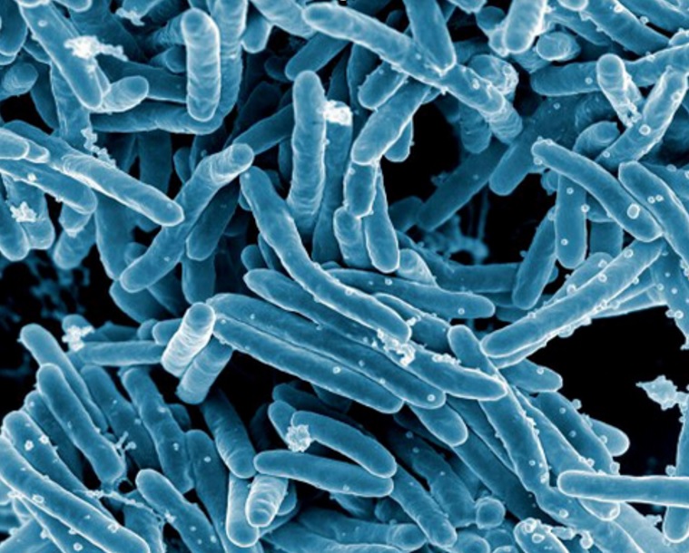 Mycobacterium tuberculosis, la bactérie responsable de la tuberculose (Visuel NIAID)