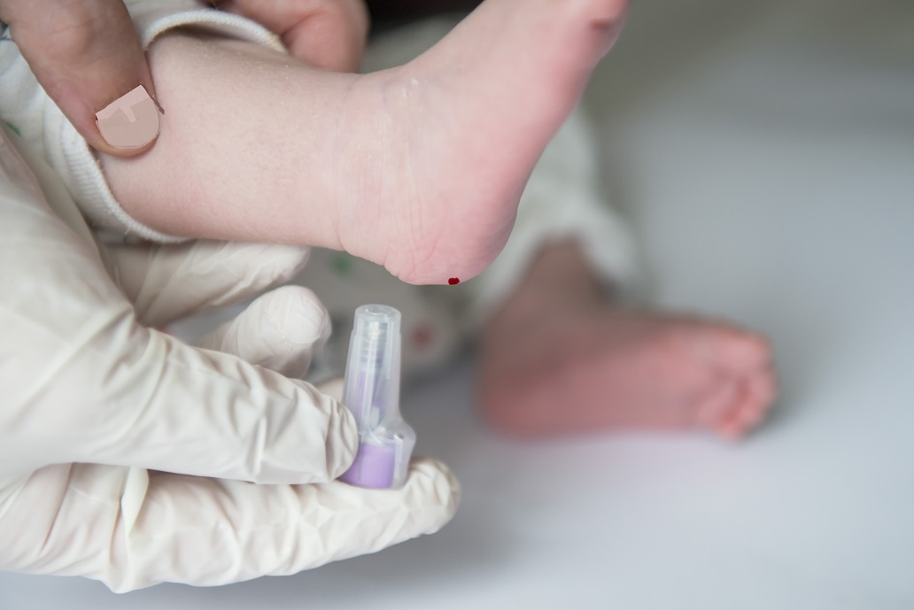 Détecter le risque élevé de diabète de type 1 et d’acidocétose dès le très jeune âge sera bientôt possible (Visuel Adobe Stock 290864517) Détecter le risque élevé de diabète de type 1 et d’acidocétose dès le très jeune âge sera bientôt possible (Visuel Adobe Stock 290864517)