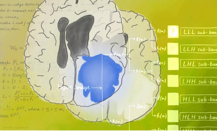 Cette nouvelle approche permet de classer les gliomes selon leur grade, faibles ou élevés avec une précision de près de 98%. (Visuel Mindy Takamiya/Kyoto University iCeMS). 