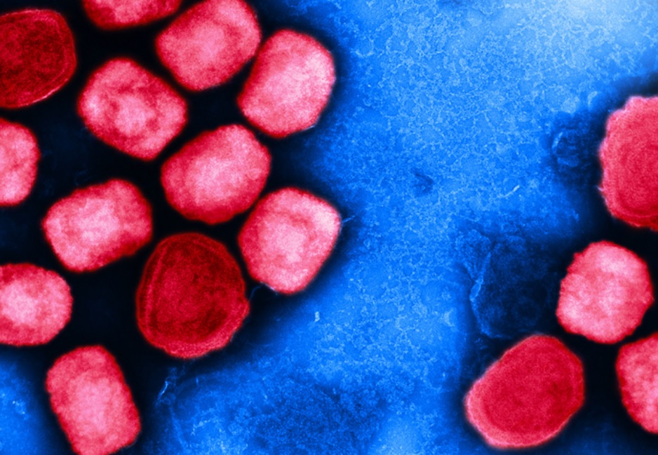 Exploiter les retours d’expérience et les réponses de santé publique aux pandémies de VIH et de COVID-19 pour faire face à cette nouvelle épidémie de variole du singe, qui, finalement pose les mêmes défis.(Visuel NIAID)