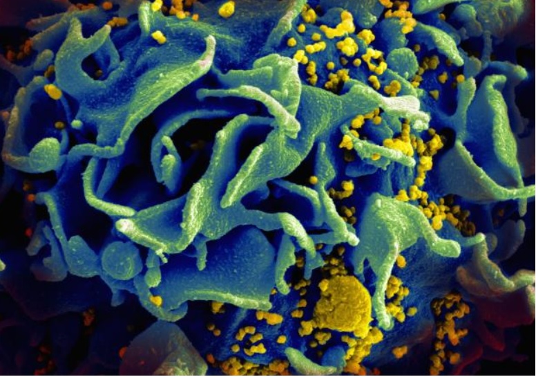 Le médicament bloque la transmission du VIH entre les cellules CD4 + et réduit par conséquent le virus latent (Voir visuel NIAID). Le médicament bloque la transmission du VIH entre les cellules CD4 + et réduit par conséquent le virus latent (Voir visuel NIAID).