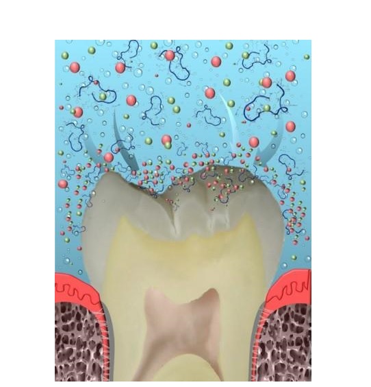 Un nouveau composite, ou un nouveau dentifrice préventif illustreront bientôt cette alternative aux soins actuels : la reminéralisation guidée par les peptides. Un nouveau composite, ou un nouveau dentifrice préventif illustreront bientôt cette alternative aux soins actuels : la reminéralisation guidée par les peptides.