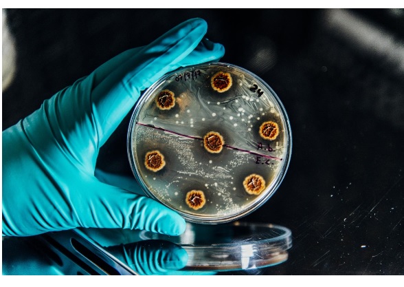 Ces avancées, présentées dans la revue Nature Communications, devraient permettre non seulement d’ouvrir les bonnes pistes pour les antimicrobiens du futur mais aussi à terme, sur un plan clinique, aider les médecins à « mieux prescrire ». Ces avancées, présentées dans la revue Nature Communications, devraient permettre non seulement d’ouvrir les bonnes pistes pour les antimicrobiens du futur mais aussi à terme, sur un plan clinique, aider les médecins à « mieux prescrire ».