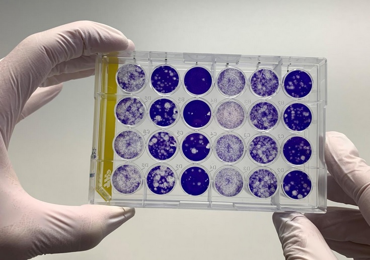 L'étude estime à 3 mois la durée de maintien moyenne des anticorps immunoglobuline G (IgG) après l'infection (Visuel Fotolia) L'étude estime à 3 mois la durée de maintien moyenne des anticorps immunoglobuline G (IgG) après l'infection (Visuel Fotolia)