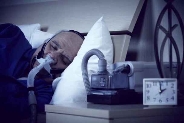 Ce guide de pratique clinique rappelle avant tout que la thérapie CPAP (Continuous Positive Airway Pressure) reste le traitement de première intention même si de nombreux patients restent encore réticents. Ce guide de pratique clinique rappelle avant tout que la thérapie CPAP (Continuous Positive Airway Pressure) reste le traitement de première intention même si de nombreux patients restent encore réticents.