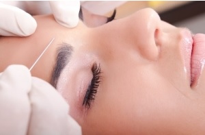 L'incidence de la dépression est réduite chez les patients ayant reçu des injections de Botox (Visuel Fotolia) L'incidence de la dépression est réduite chez les patients ayant reçu des injections de Botox (Visuel Fotolia)
