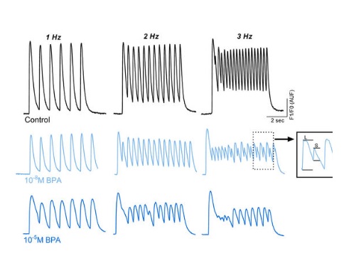 Le cœur immature ou en développement peut répondre au BPA par des troubles ou dysfonctionnements cardiaques, dont des rythmes plus lents ou irréguliers par exemple 