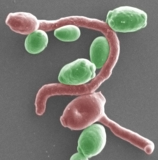 La découverte que ces champignons intestinaux pourraient être impliqués dans l’étiologie des MICI suggèrent l’intérêt de combiner une thérapie antifongique aux traitements standards La découverte que ces champignons intestinaux pourraient être impliqués dans l’étiologie des MICI suggèrent l’intérêt de combiner une thérapie antifongique aux traitements standards