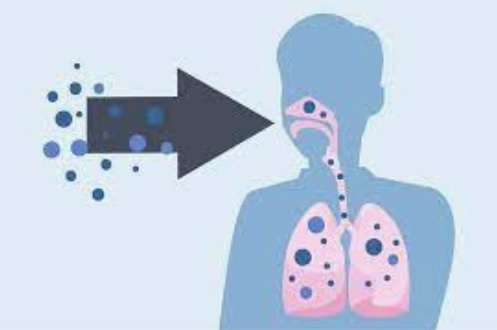 La mucormycose, une infection fongique invasive, qui touche ici les sinus et les poumons est une nouvelle complication documentée avec le COVID-19 (Visuel CDC)