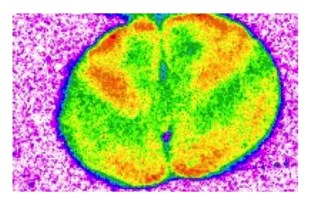 Les souris exposées à long terme au médicament présentent des troubles de la mémoire au point de ne plus pouvoir faire la distinction entre un objet familier et un nouvel objet