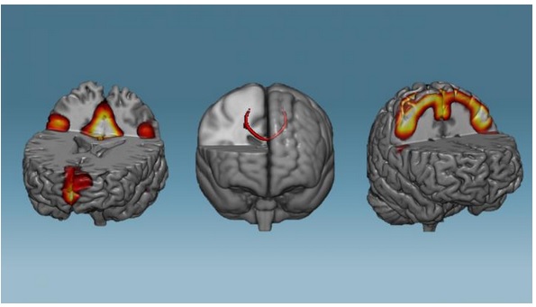 Ces scientifiques ont mis au point une technique d’entraînement cérébral capable d’induire des modifications des réseaux de neurones… en moins d’une heure. Ces scientifiques ont mis au point une technique d’entraînement cérébral capable d’induire des modifications des réseaux de neurones… en moins d’une heure.