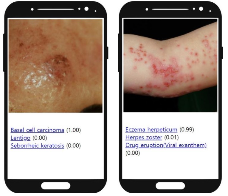 https://www.santelog.com/sites/santelog.com/www.santelog.com/files/images/accroche/visuel_dermato_app.jpg