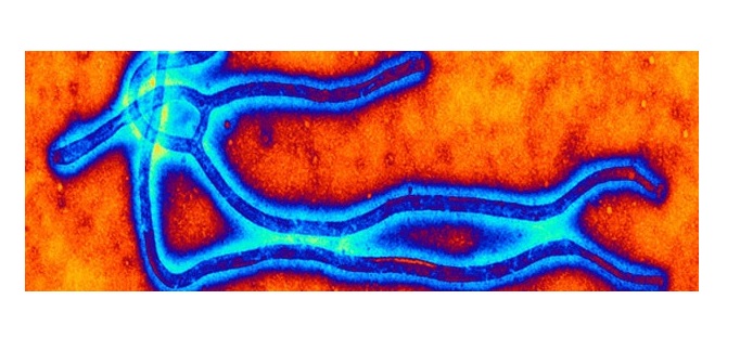 Les hommes peuvent « héberger » le virus Ebola dans leur sperme pendant au moins 2,5 ans.