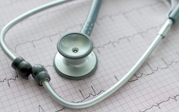 La fibrillation auriculaire est le trouble du rythme cardiaque le plus courant, et la cause de 20 à 30% des accidents vasculaires cérébraux (AVC). 