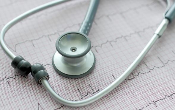 La fibrillation auriculaire est le trouble du rythme cardiaque le plus courant, et la cause de 20 à 30% des accidents vasculaires cérébraux (AVC). La fibrillation auriculaire est le trouble du rythme cardiaque le plus courant, et la cause de 20 à 30% des accidents vasculaires cérébraux (AVC).