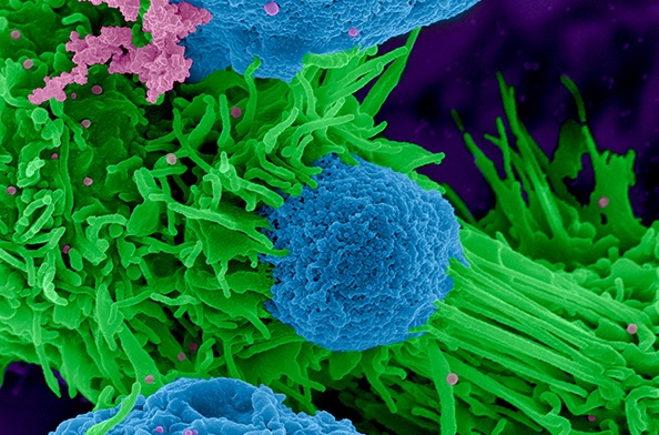 Le Sargramostime à base de protéine humaine GM-CSF est utilisé pour stimuler la moelle osseuse à produire plus de globules blancs macrophages (Visuel) et granulocytes (Visuel NIH)