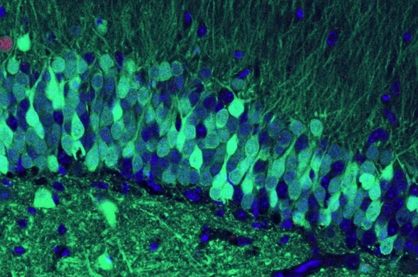 Et si les scientifiques pouvaient manipuler votre cerveau de manière à effacer un souvenir traumatique et rappeler un souvenir heureux ?