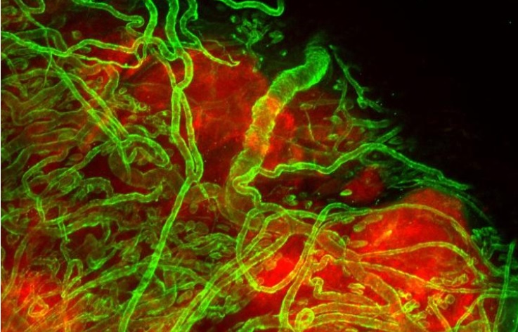 Les cellules cancéreuses peuvent rapidement s’approprier des vaisseaux sanguins existants (Vanesa Silvestri, Ph.D./Johns Hopkins Medicine)