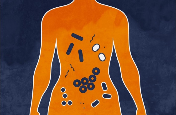 La perturbation des bactéries intestinales rend le cancer plus agressif La perturbation des bactéries intestinales rend le cancer plus agressif