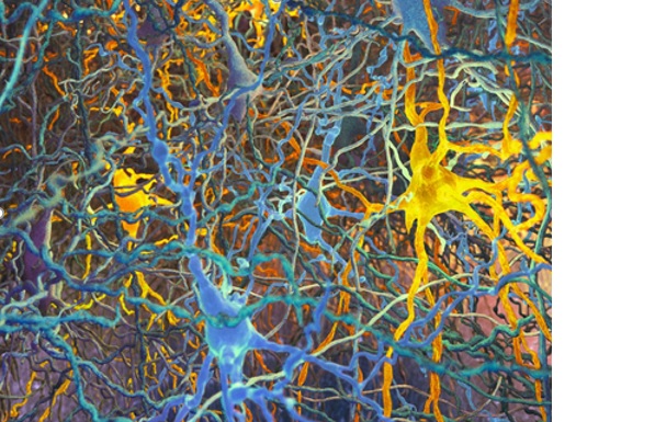 Jusque-là, il n’existait pas de classification des différents types de neurones. Jusque-là, il n’existait pas de classification des différents types de neurones.