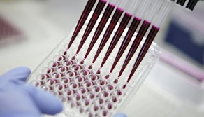 Le dispositif collecte en continu des cellules cancéreuses vivantes directement à partir du sang du patient. Le dispositif collecte en continu des cellules cancéreuses vivantes directement à partir du sang du patient.
