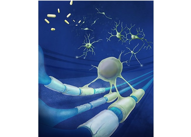 Le siponimod est censé réduire les effets néfastes de l'activité immunitaire sur les nerfs dans le cerveau et la moelle épinière en piégeant les globules blancs destructeurs du corps. 