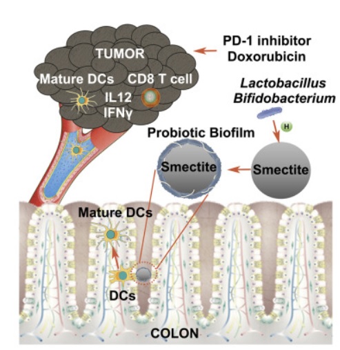 Des microsphères « smectite-lactobacillus-biofilm » (SLB) apportent un effet antitumoral encore plus significatif que l'utilisation de Smectite ou de Lactobacillus seuls(Université de Nanjing ) Des microsphères « smectite-lactobacillus-biofilm » (SLB) apportent un effet antitumoral encore plus significatif que l'utilisation de Smectite ou de Lactobacillus seuls(Université de Nanjing )