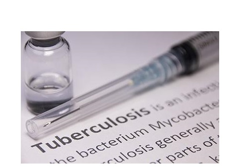 Avec près de 10 millions de cas dans le monde et 1,7 million de décès, la tuberculose (TB) reste la seconde cause de mortalité liée à un agent infectieux unique. Avec près de 10 millions de cas dans le monde et 1,7 million de décès, la tuberculose (TB) reste la seconde cause de mortalité liée à un agent infectieux unique.