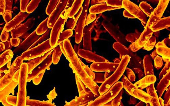 Mycobacterium tuberculosis est l'une des principales causes de décès dans le monde, entraînant plus de 1,5 million de décès par an (Visuel National Institute of Allergy and Infectious Diseases). 