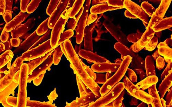 Mycobacterium tuberculosis est l'une des principales causes de décès dans le monde, entraînant plus de 1,5 million de décès par an (Visuel National Institute of Allergy and Infectious Diseases) Mycobacterium tuberculosis est l'une des principales causes de décès dans le monde, entraînant plus de 1,5 million de décès par an (Visuel National Institute of Allergy and Infectious Diseases).