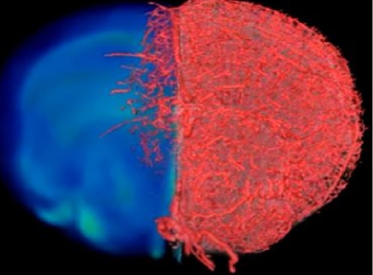 « Rendre l'invisible visible » et pouvoir obtenir une image précise du flux sanguin, à l’échelle du vaisseau, en bonne santé ou malade, c’est la prouesse réalisée avec cette nouvelle technique d'imagerie (Visuel Johns Hopkins Medicine) « Rendre l'invisible visible » et pouvoir obtenir une image précise du flux sanguin, à l’échelle du vaisseau, en bonne santé ou malade, c’est la prouesse réalisée avec cette nouvelle technique d'imagerie (Visuel Johns Hopkins Medicine)