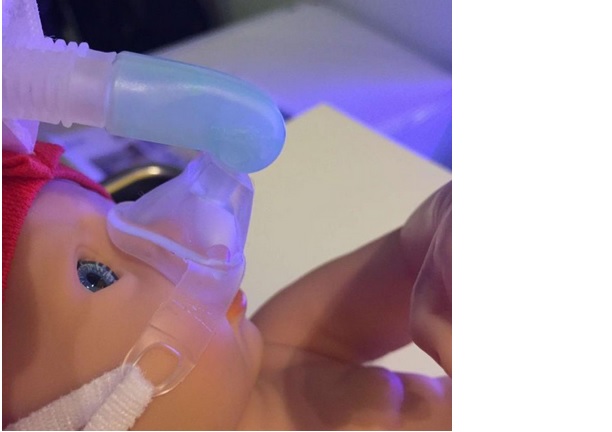 Comme la NCPAP, la NHFOV est non invasive, et permet, en plus, une meilleure élimination du CO2 et une capacité fonctionnelle accrue. Comme la NCPAP, la NHFOV est non invasive, et permet, en plus, une meilleure élimination du CO2 et une capacité fonctionnelle accrue.