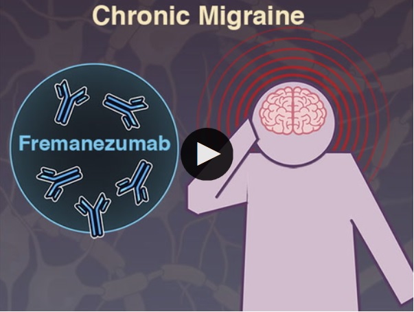 Cette thérapie par anticorps contre une molécule inflammatoire clé, impliquée dans les migraines, réduit en effet la fréquence des crises.