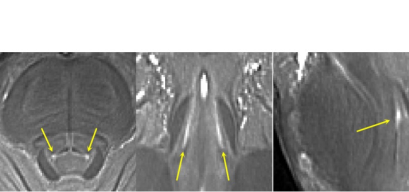 Alors que la plupart des scanners IRM ont tendance à être « 3T » ou moins et ne permettent pas de visualiser avec suffisamment de précision le locus coeruleus, les scanners 7T, qui ont des champs magnétiques ultra-puissants, peuvent fournir une résolution de la taille d'un grain de sable (Visuel Université de Cambridge) Alors que la plupart des scanners IRM ont tendance à être « 3T » ou moins et ne permettent pas de visualiser avec suffisamment de précision le locus coeruleus, les scanners 7T, qui ont des champs magnétiques ultra-puissants, peuvent fournir une résolution de la taille d'un grain de sable (Visuel Université de Cambridge)