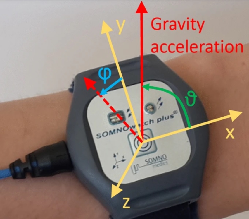 Le tracker détecte le moindre mouvement, même si le bras du patient tourne légèrement lorsqu'il respire pendant son sommeil (Visuel Universitätsmedizin Berlin) Le tracker détecte le moindre mouvement, même si le bras du patient tourne légèrement lorsqu'il respire pendant son sommeil (Visuel Universitätsmedizin Berlin)